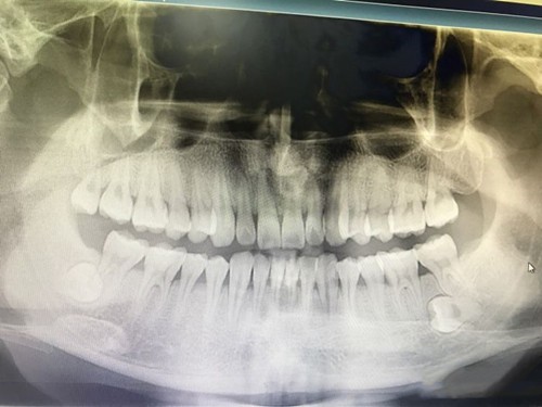 西藏雅博仕口腔医院牙片