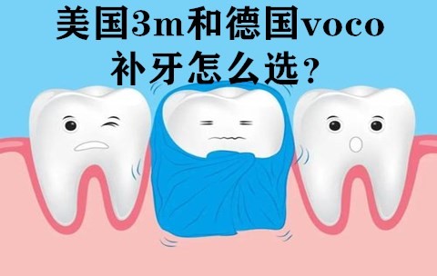 美国3M和德国voco补牙哪个好？voco补牙多少钱一颗能用多久？
