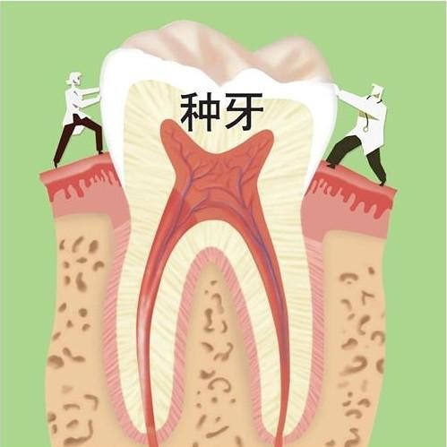 种植过牙的人亲身经历：韩国登腾种植牙3900元一颗，1年后感受还不错