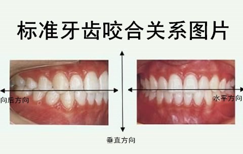 看图自测自己是否是标准牙齿咬合图片，咬合不正常会有什么影响？