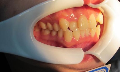 武汉牙齿矫正医生排名公布，告诉你哪个医院正畸比较好