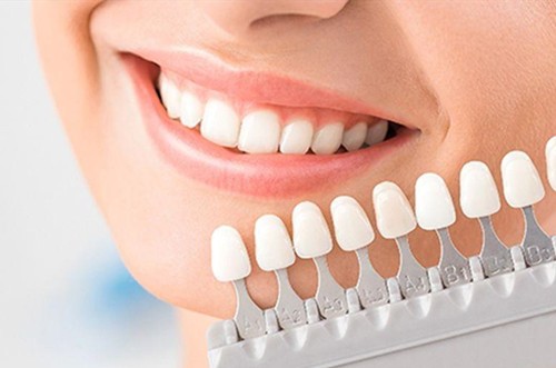 惠州牙齿美白多少钱？在惠州哪家牙科医院做的比较好？