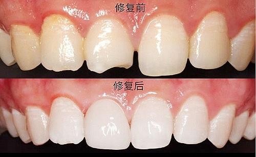青岛市口腔医院收费标准2021版公布,牙套牙冠拔智齿价格都有