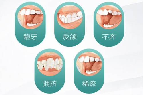 牙齿矫正的成功标准是什么？牙齿排挤就行了吗？