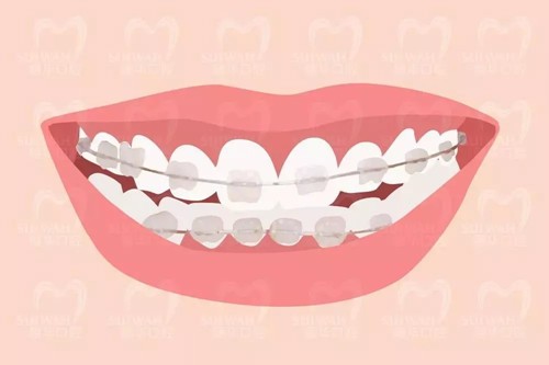 成年人千万不要矫正，正畸牙齿后遗症太可怕了