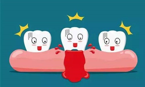 最近每天刷牙出血是怎么回事？医生给了我这个答案