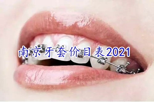 南京牙齿矫正一般多少钱？2021南京牙套价目表公布