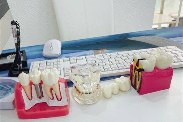 弗莱堡口腔种植牙价格表查询,3D导板种植技术好还实惠,可在线预约种牙