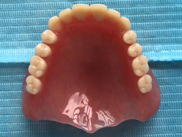 老人无牙牙床萎缩吸附式假牙好用吗?临床解答牙龈萎缩还能镶牙吗?
